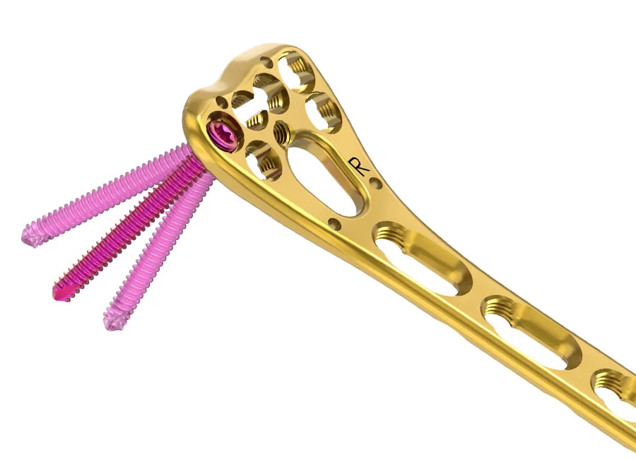 Orthopedic Implants